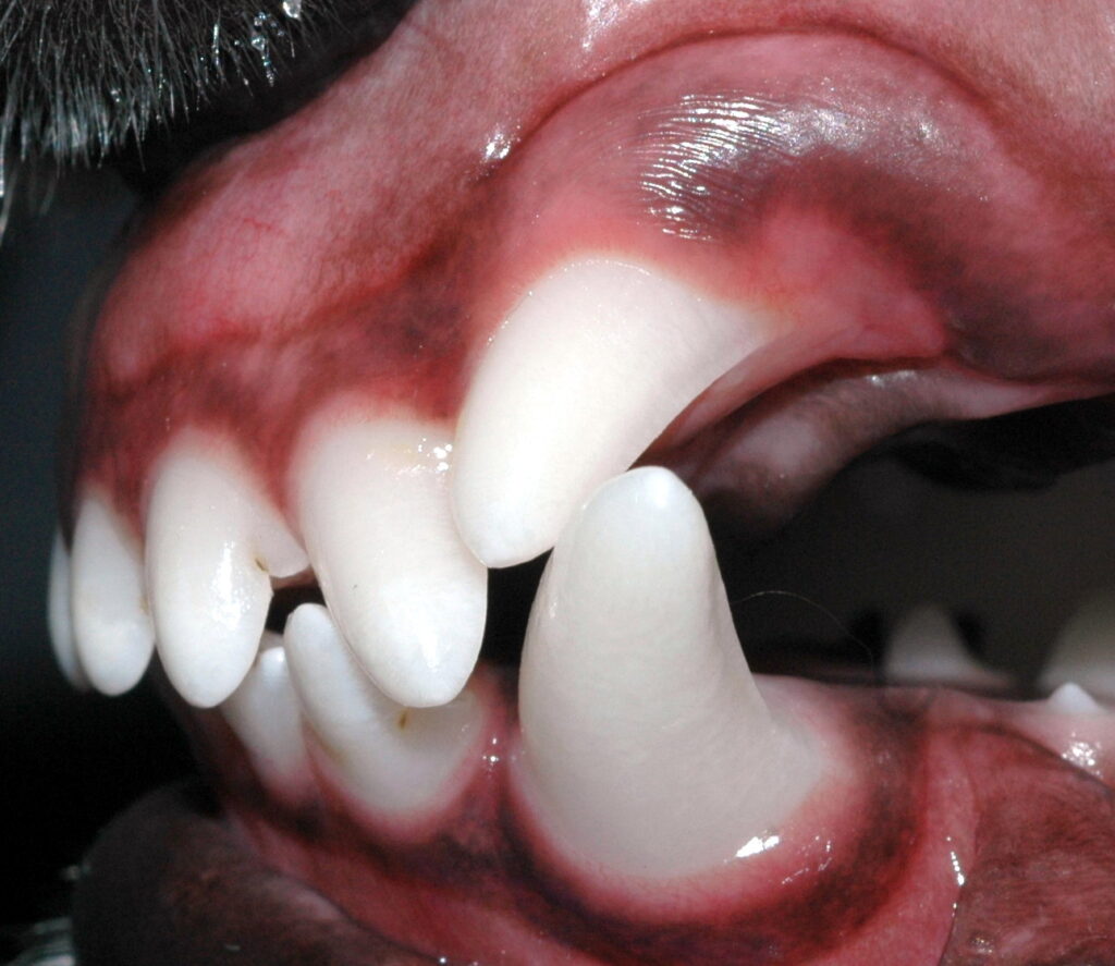 Malpositioned upper canine tooth 